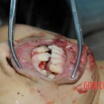 Chinese girl in morgue