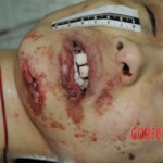 Chinese girl in morgue