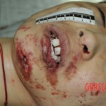 Chinese girl in morgue