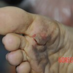 Chinese girl in morgue