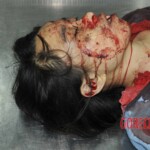 Chinese girl in morgue