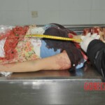 Chinese girl in morgue