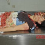Chinese girl in morgue