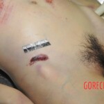 Chinese woman in morgue