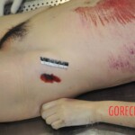 Chinese woman in morgue