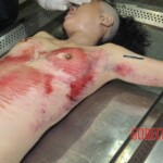 Chinese woman in morgue