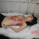 Chinese woman in morgue