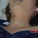 Naked dead woman in morgue