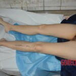 Naked dead woman in morgue