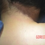 Naked dead woman in morgue