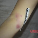 Naked dead woman in morgue