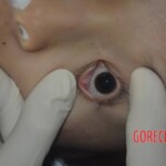 Naked dead woman in morgue