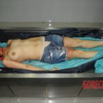 Murdered woman on autopsy table