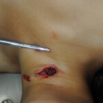 Murdered woman on autopsy table