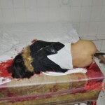 Murdered young woman with knife in pussy + autopsy