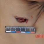 Murdered young woman with knife in pussy + autopsy