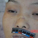 Murdered young woman with knife in pussy + autopsy