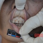 Murdered young woman with knife in pussy + autopsy