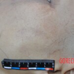 Murdered young woman with knife in pussy + autopsy