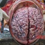 Murdered young woman with knife in pussy + autopsy