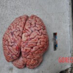 Murdered young woman with knife in pussy + autopsy