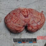 Murdered young woman with knife in pussy + autopsy