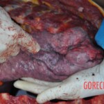 Murdered young woman with knife in pussy + autopsy