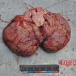 Murdered young woman with knife in pussy + autopsy