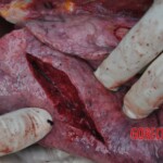 Murdered young woman with knife in pussy + autopsy