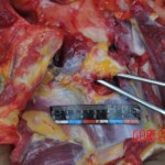 Murdered young woman with knife in pussy + autopsy