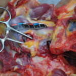 Murdered young woman with knife in pussy + autopsy