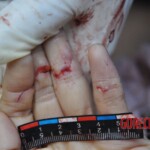 Murdered young woman with knife in pussy + autopsy