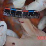 Murdered young woman with knife in pussy + autopsy