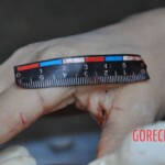 Murdered young woman with knife in pussy + autopsy