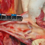 Murdered young woman with knife in pussy + autopsy