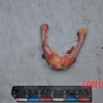 Murdered young woman with knife in pussy + autopsy