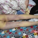 Dead young chinese girl in bed
