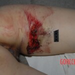 Young Chinese woman died in traffic accident