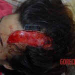 Young Chinese woman died in traffic accident