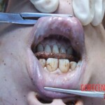 Raped naked chinese girl