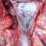 Raped naked chinese girl