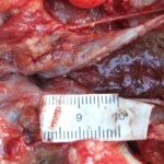 Raped naked chinese girl