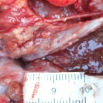 Raped naked chinese girl