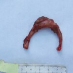 Raped naked chinese girl