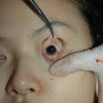 Young Chinese woman worked herself to death