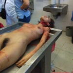 Autopsy of woman