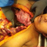 Autopsy of woman