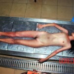 Autopsy of woman