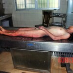 Autopsy of woman