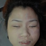 Naked dead girl in morgue